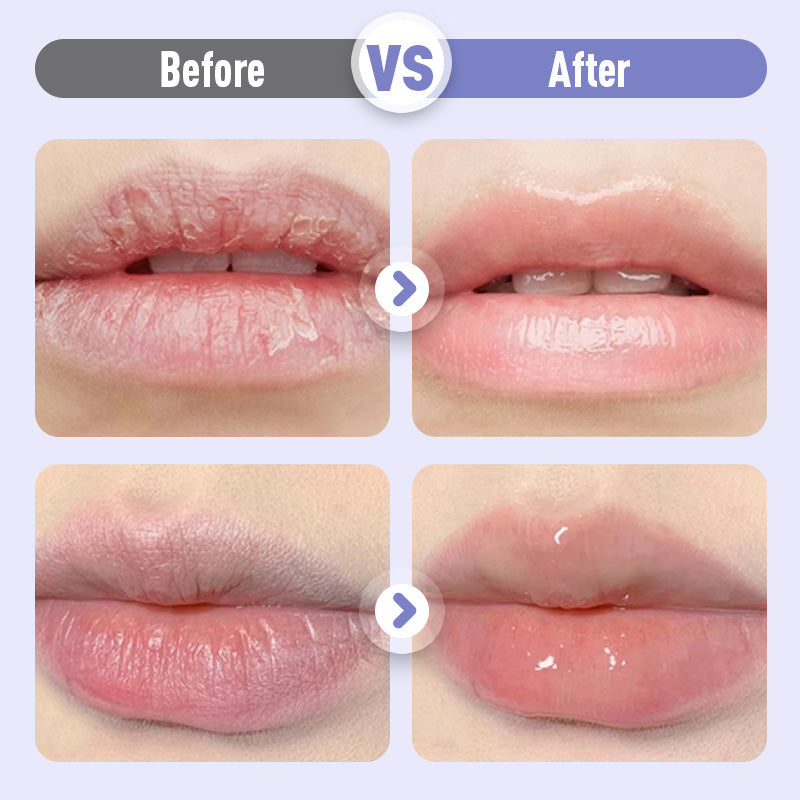 👑Feuchtigkeitsspendendes Lippenserum, das die Lippen aufpolstert und Fältchen bekämpft💋
